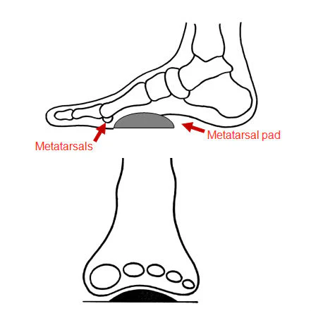 Pedag Metatarsal Pad - Image 4