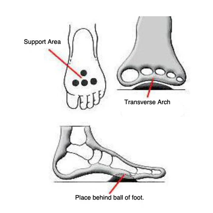 Pedag Metatarsal Pad - Image 5